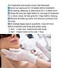 Pico Laser Tattoo Removal